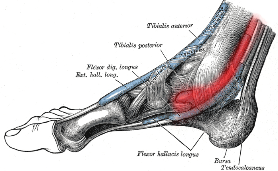 Shoe inserts for hot sale posterior tibial tendonitis